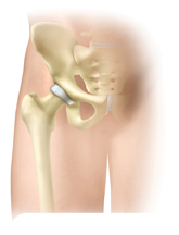 Healthy Hip